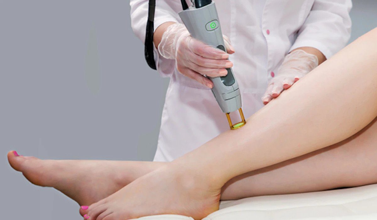 Hair removing laser treatment in Lahore | Rizthetics