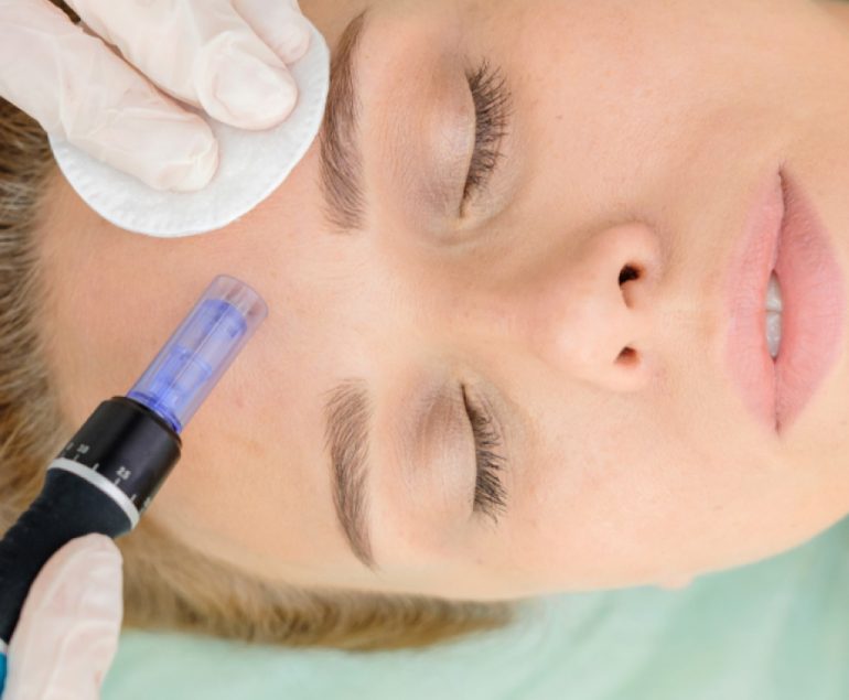 Best microneedling in Lahore | Rizthetics