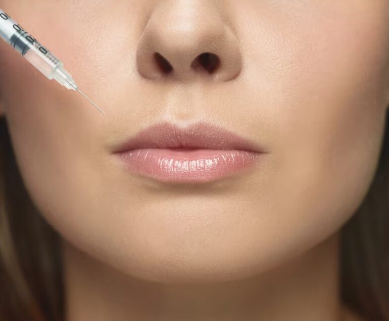 Lip Fillers in Lahore | Rizthetics,