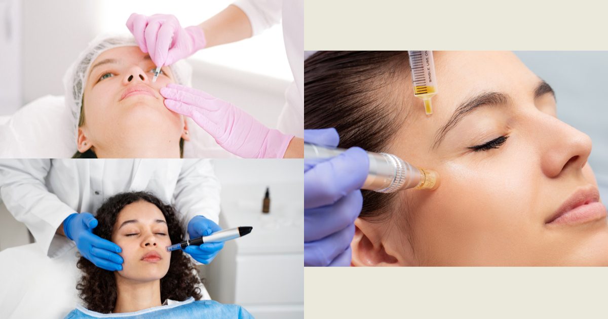 Aesthetics clinic Lahore, Face-Microneedling