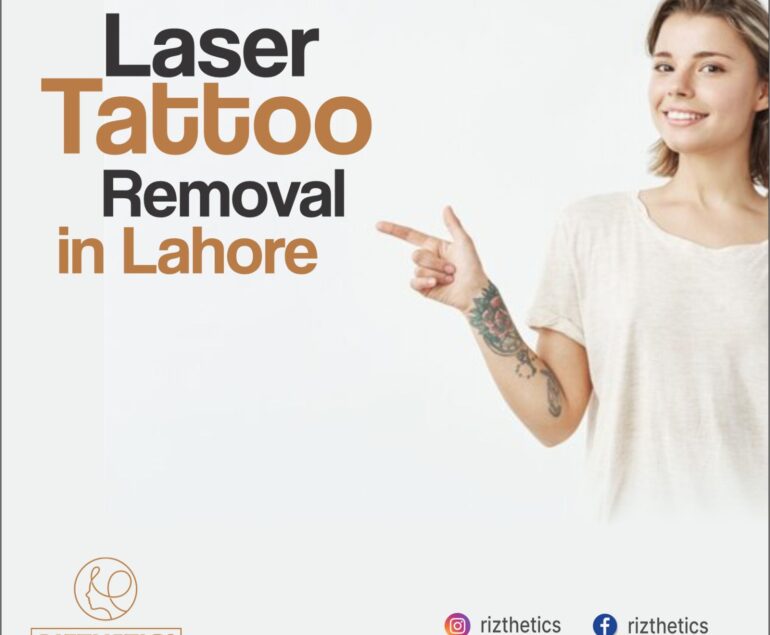 Laser Tattoo Removal in Lahore | Laser Tattoo Removal | RIZTHETICS