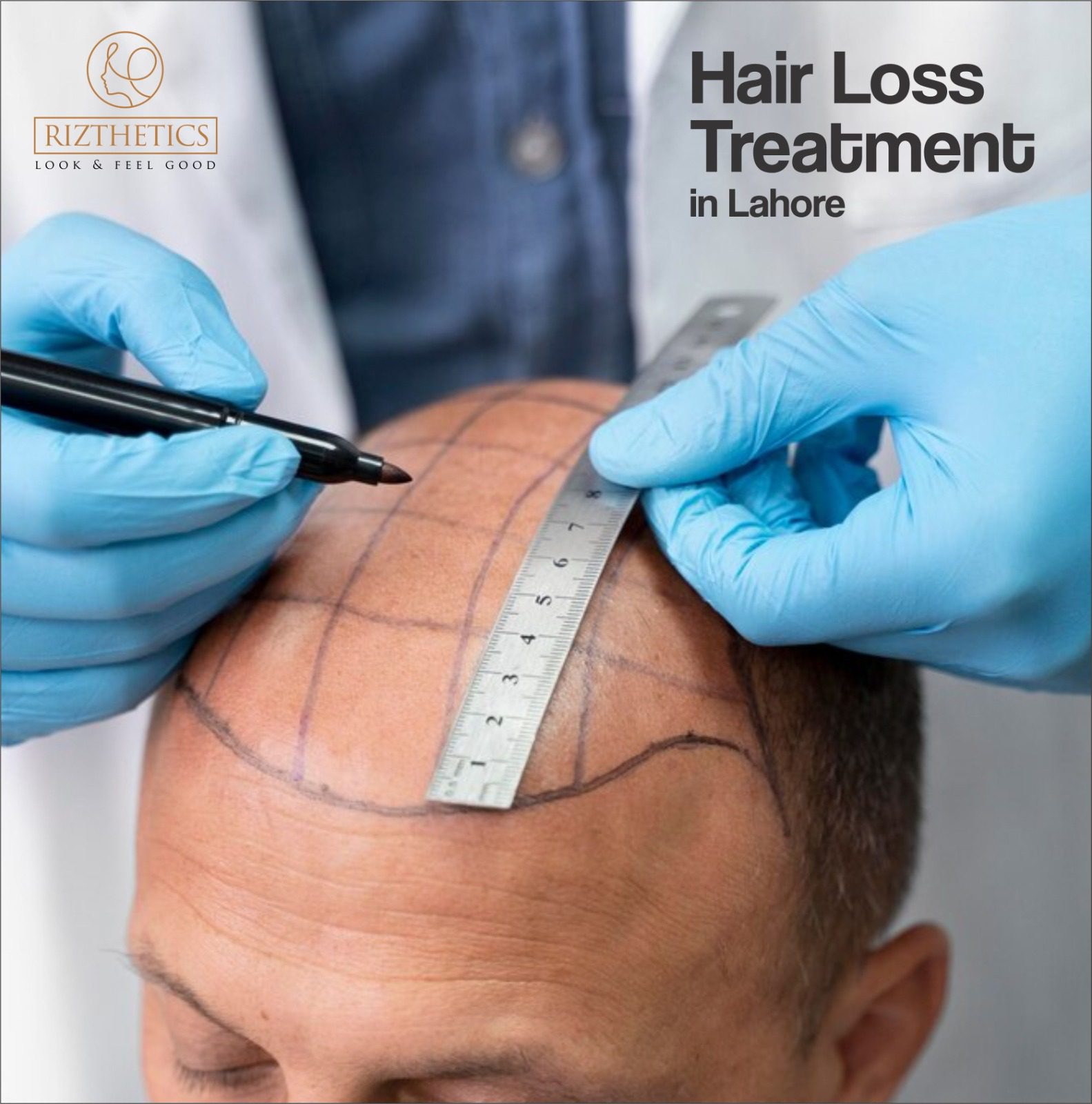 Hair Loss Treatment in Lahore | Rizthetics