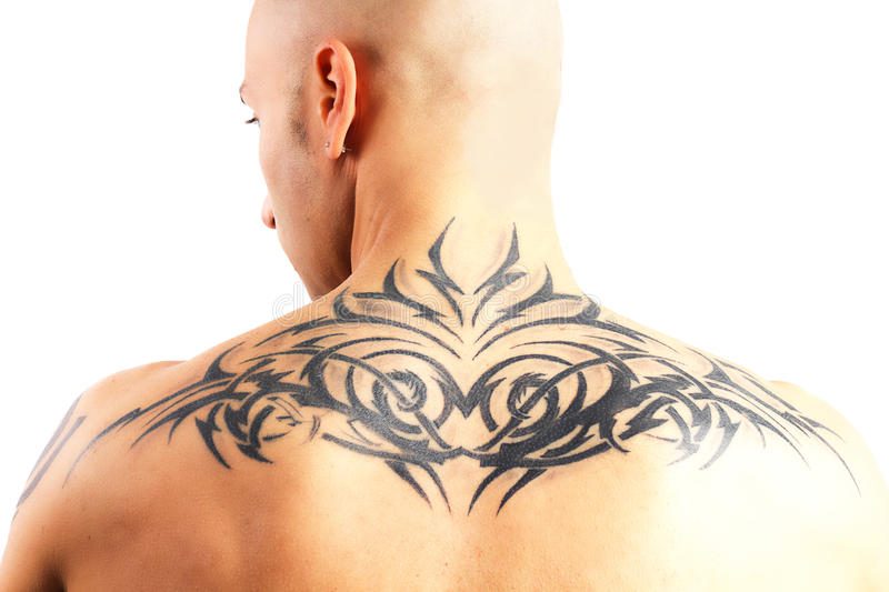 Laser Tattoo Removal